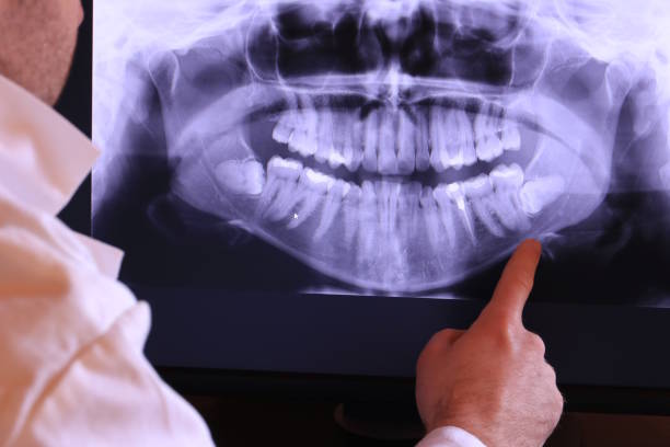 Best Emergency Dental Extractions in Woodburn, IN